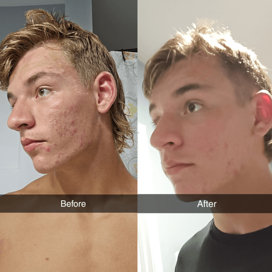 Shield System Face Wash
