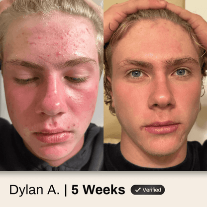 Face System