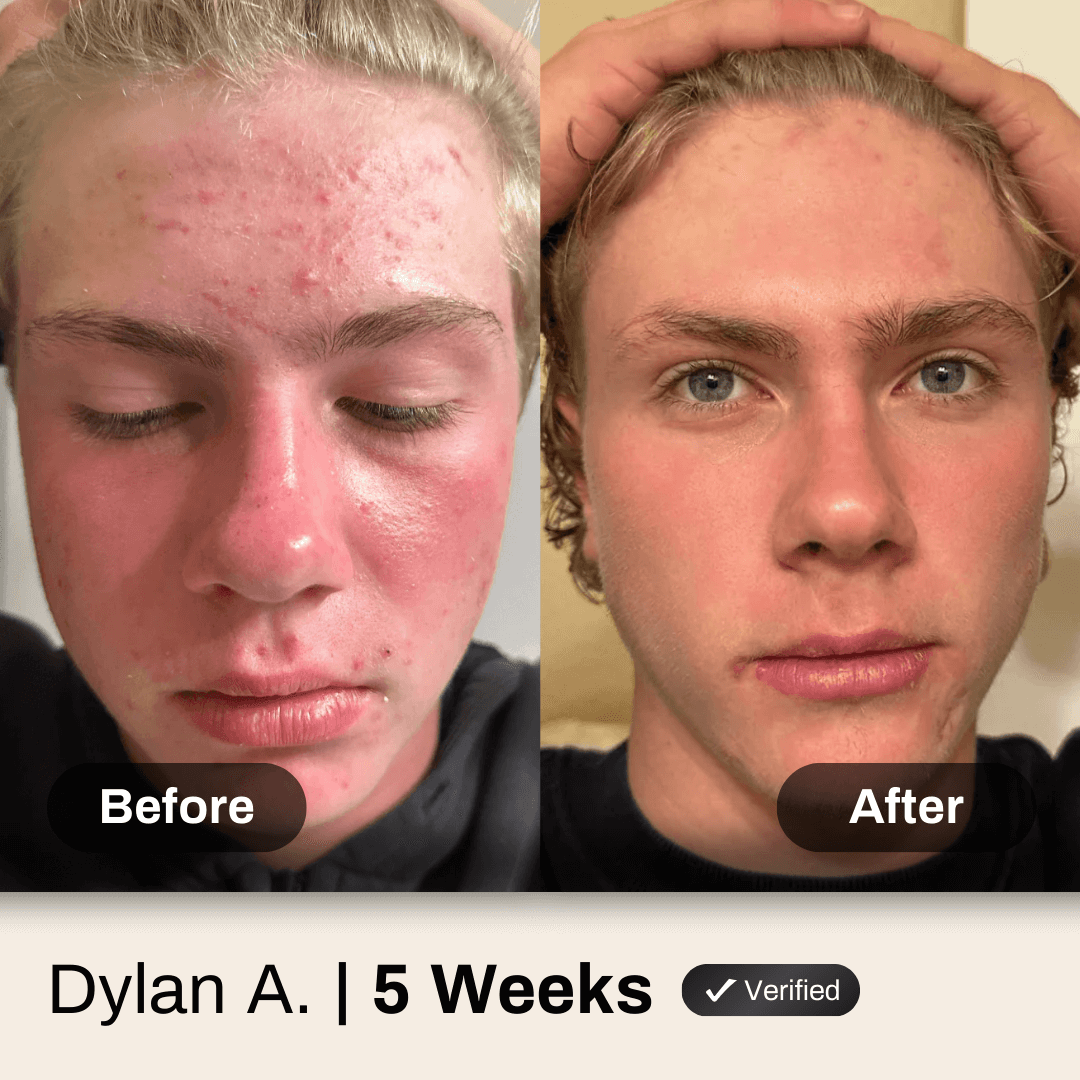BOGO Face & Body System