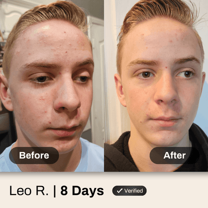 BOGO Instant Clear