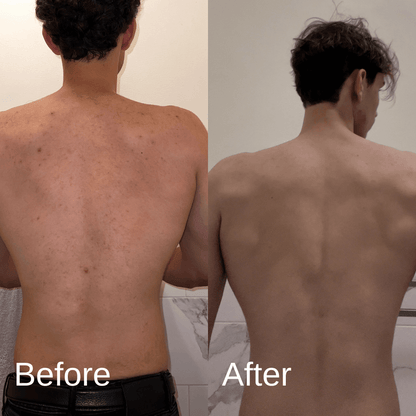 Shield System Body Acne Wash