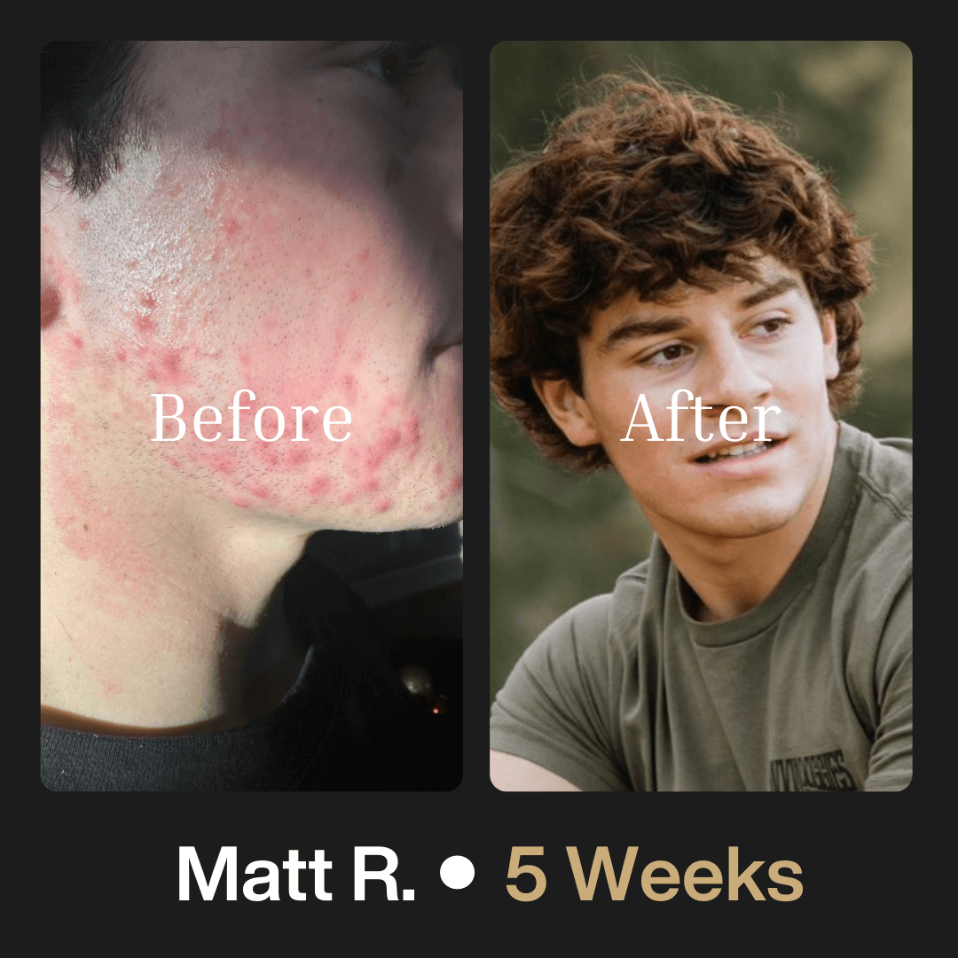 Advanced Face System