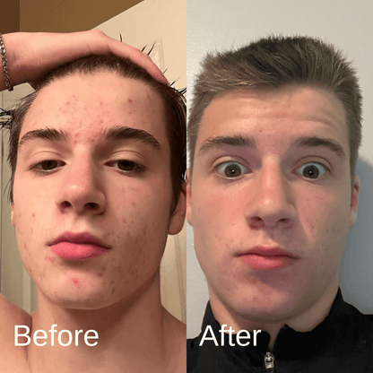Shield System Face Wash