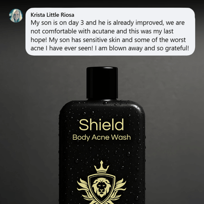Shield System Body Acne Wash